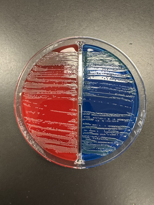 microbiology round - 亀田総合病院 感染症内科