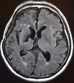 検査機器｜我孫子市 ほしの脳神経クリニック | 脳神経外科 内科