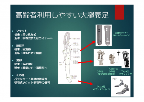 高齢者の義足リハビリテーション | パシフィックニュース