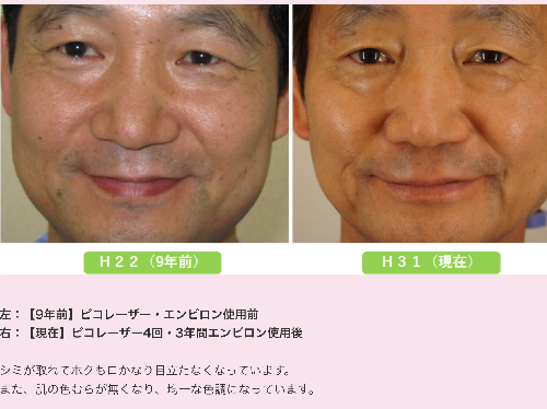 浸透100倍】エンビロン コスメティックロールキットの効果と使い方