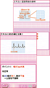 メディカ出版｜トレーニングDSシリーズWEBサイト(さくさく人工呼吸ケア