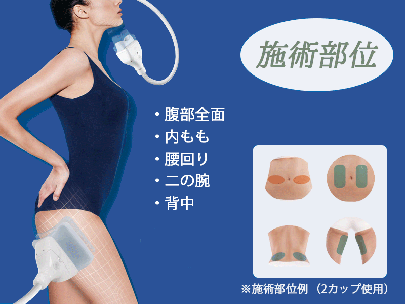 冷却痩身 – CLATUUα（クラツーアルファ） - ACCエイジングケア