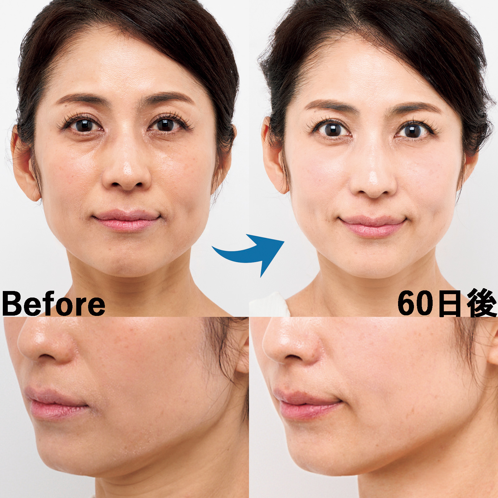 40代・50代読者8名のビフォー＆アフター公開！“最新美顔器”を60日試し