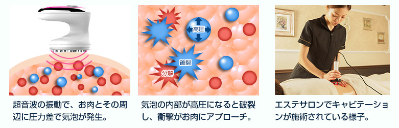 美ルルキャビアップ＜belulu Caviup＞ビルル製品情報