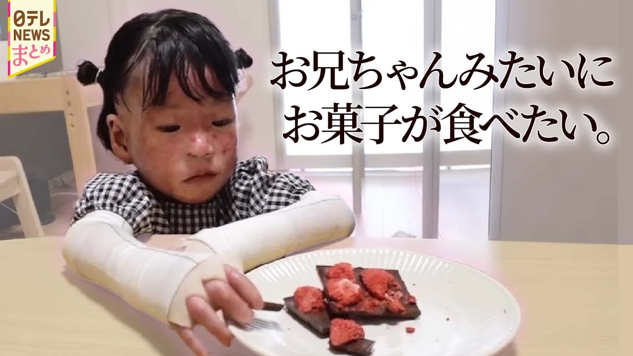 難病の少女” のために医師が作ったチョコ / なぜ私が…若年性認知症