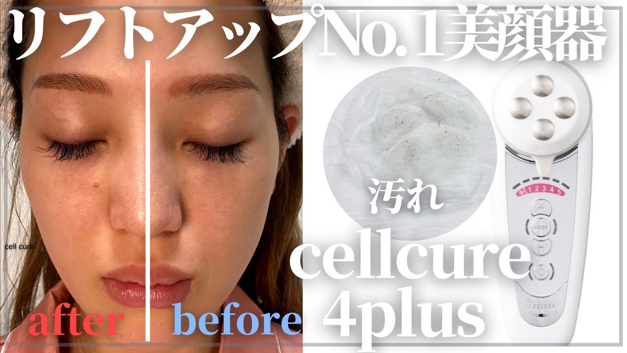 法令線が消える小顔美顔器】医療並の引き上げ‼️セルキュア4tプラスを