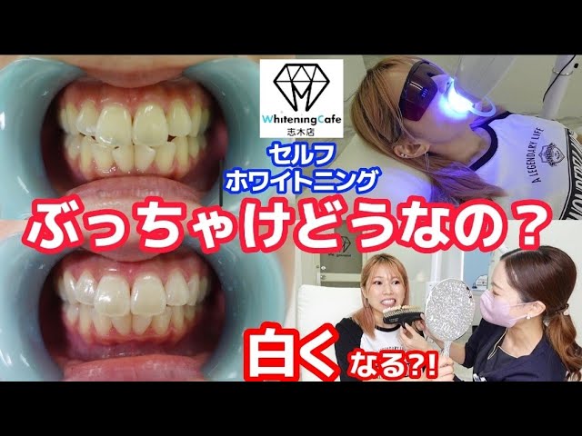 Whitening Cafe] Shiki Branch ☆ Is self-whitening ineffective