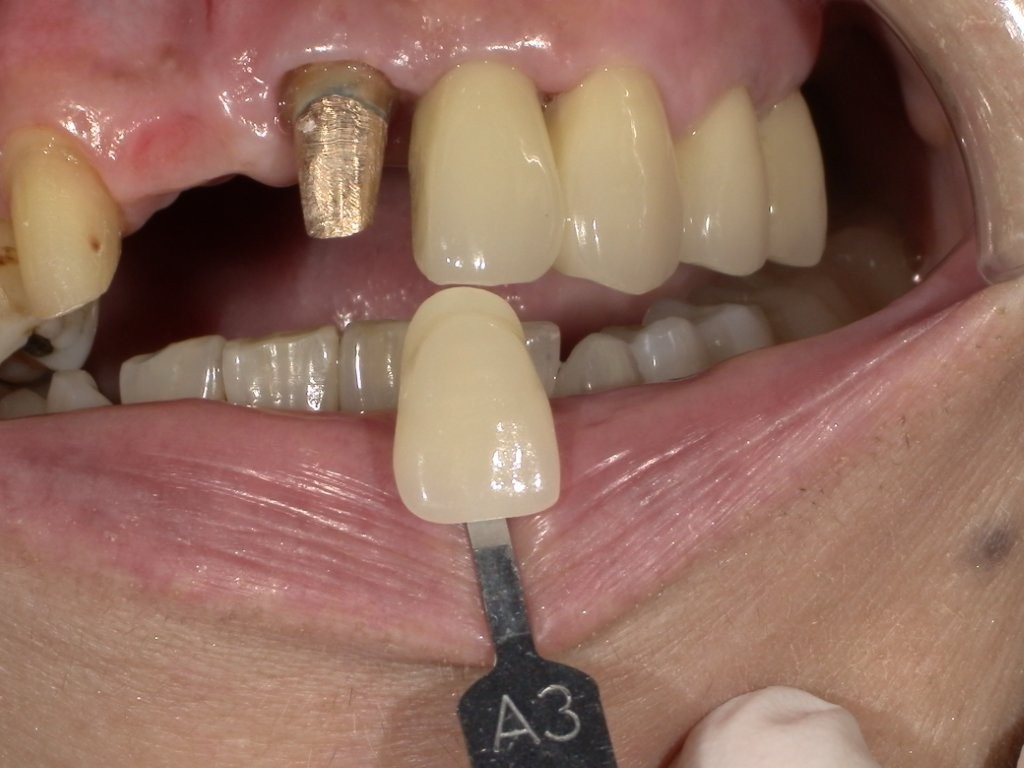 口腔内カメラ | スマイルデンタルクリニック世田谷 千歳烏山